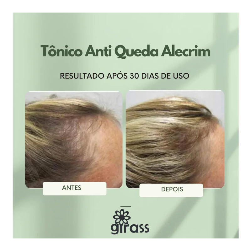Tonico Anti Queda Girass 120ml